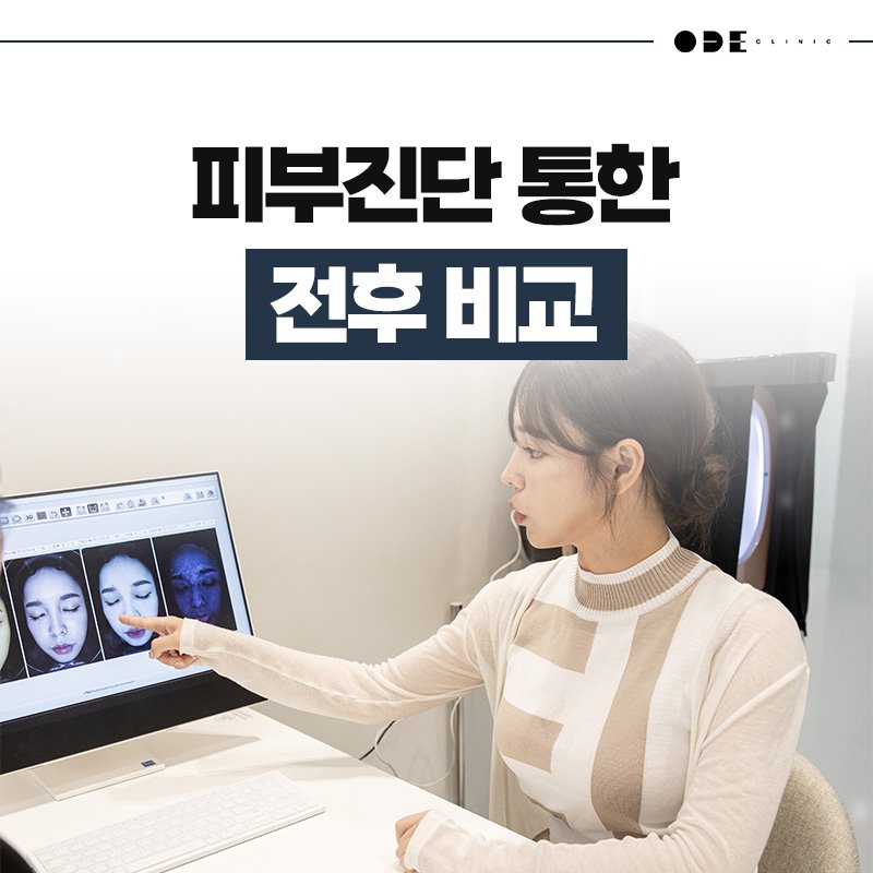 subtle facial rejuvenation Seoul